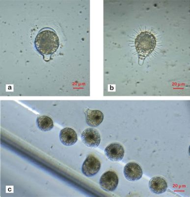 Strombidium! En liten ciliat med många ben som lever i det öppna havet