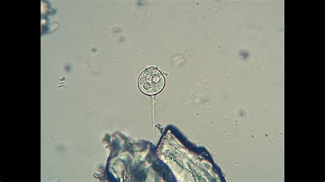  Vorticella! En fascinerande dvärgvirvel som kan ge liv åt en vattenpelare